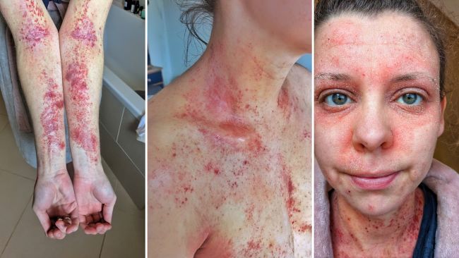 Lady with TSW arms chest face